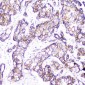 Anti-beta Catenin CTNNB1 Antibody Picoband™ (monoclonal, 1F6)